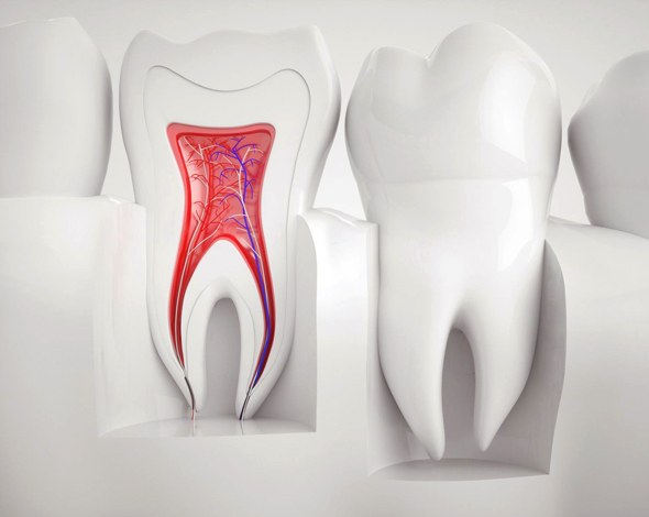 root canal therapy layton| root canal treatment in pleasant view